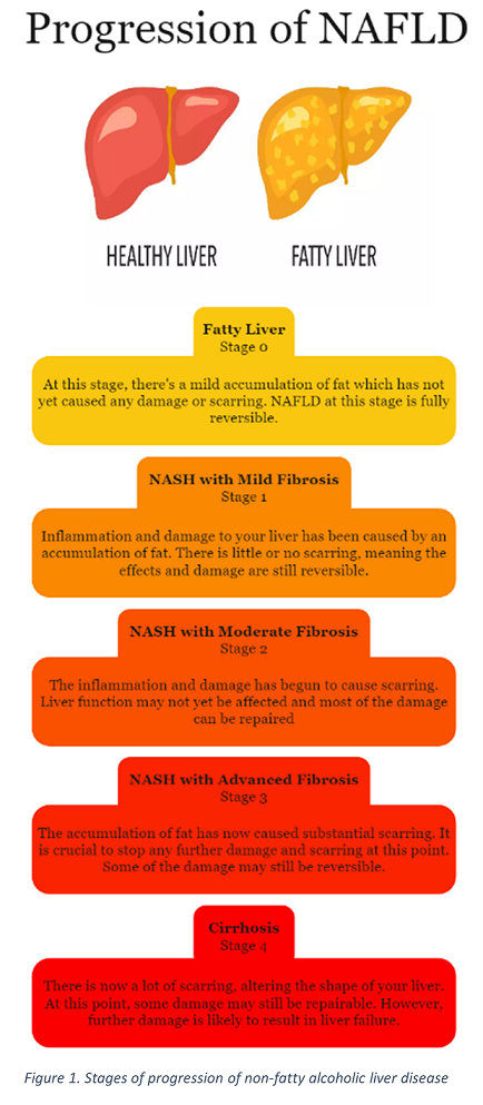 Non-Alcoholic Fatty Liver Disease - Liver Health